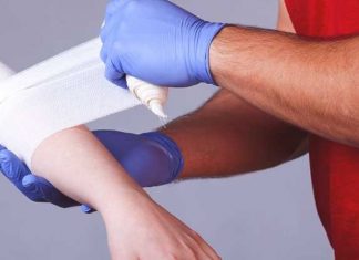 Hướng dẫn sơ cứu vết bỏng đúng cách