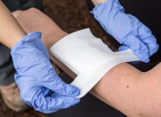 Xử lý vết cắt, trầy xước khi hoạt động ngoài trời